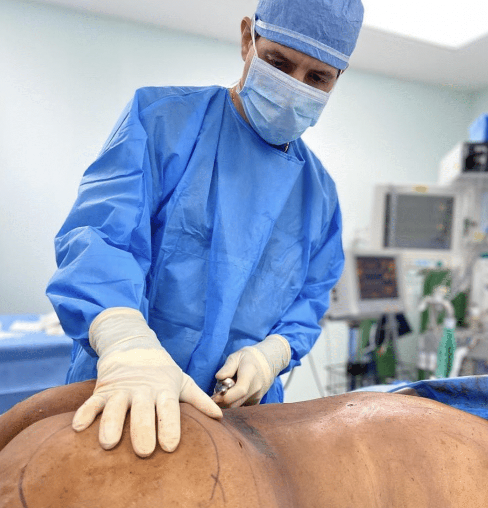 A butt lift is being performed