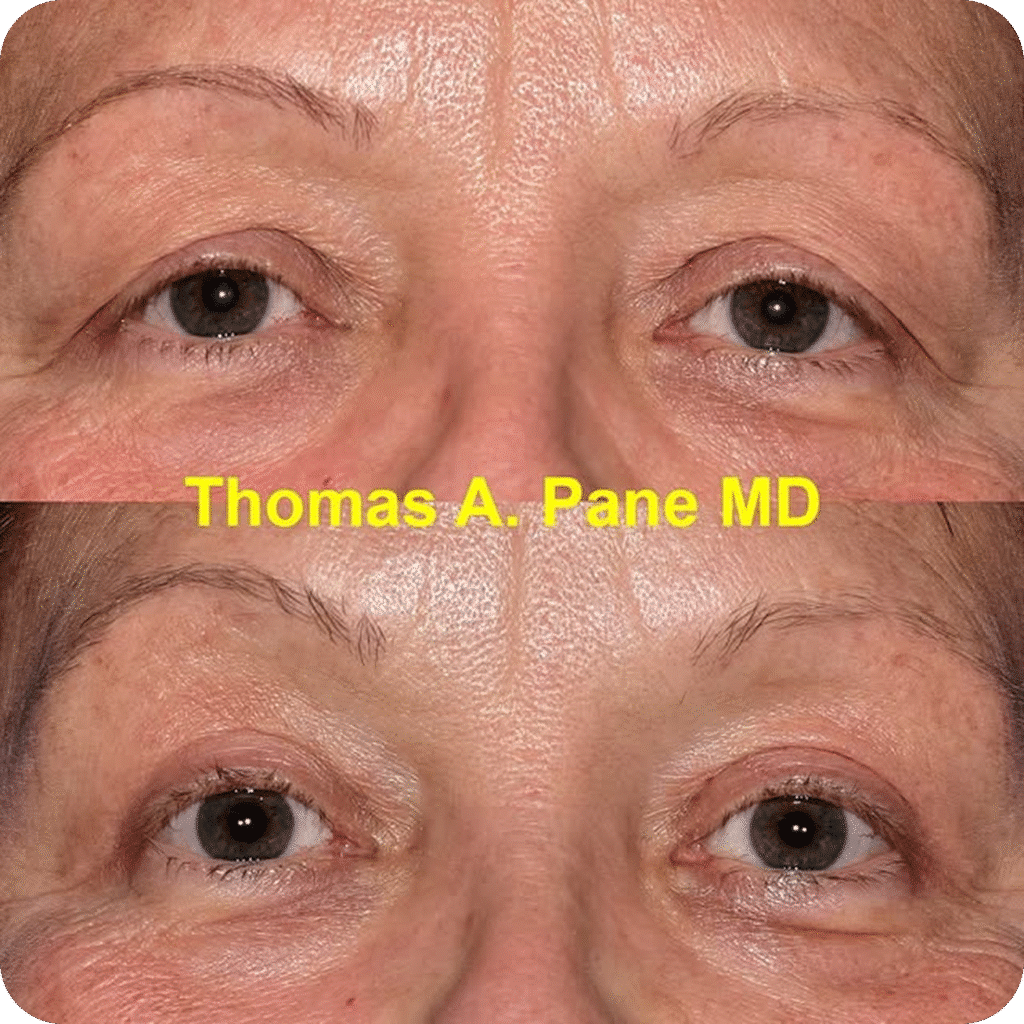 Rectangle 1585 Thomas Pane, MD Plastic Surgery