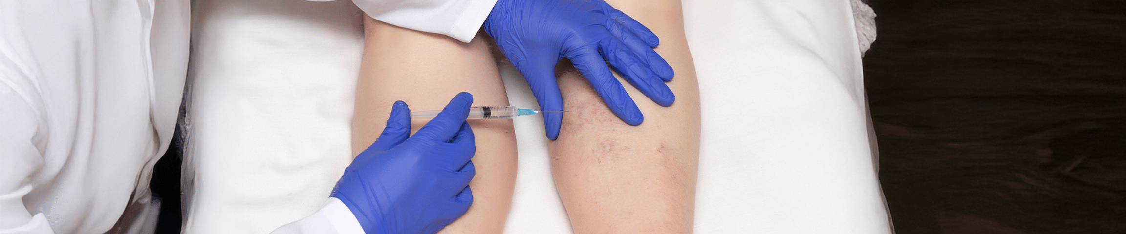 Sclerotherapy in Palm Beach Gardens and West Palm Beach, FL