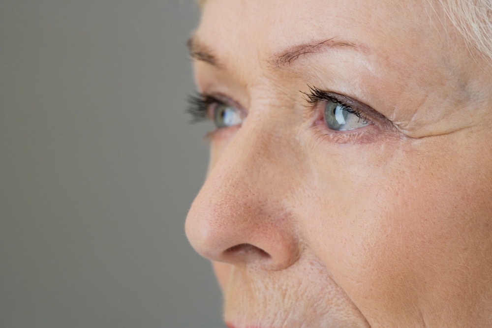 Close-up of mature woman’s face representing treatment for visible facial spider veins in Palm Beach Gardens.