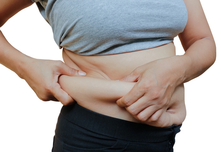 Alt text: Woman holding excess abdominal skin, representing post bariatric body contouring after major weight loss.